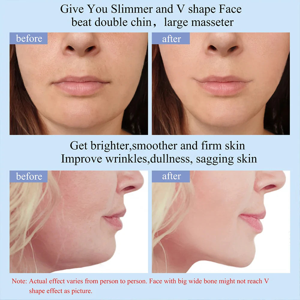 SlimFlow™ – EMS Lymphatic Massager